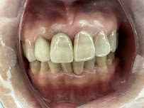 Precision Smiles Dental Lab