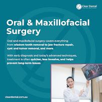 Clear Aligners Sydney (formerly known as Wynyard Dental)