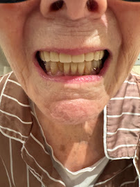Your Denture Man