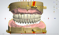 Your Denture Man