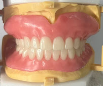 Your Denture Man