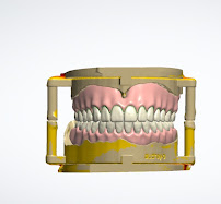 Your Denture Man in Sydney