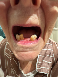 Your Denture Man