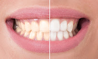 Pain Free Dentist Sydney - Dentist Dulwich Hill, Hurlstone Park NSW