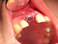 Pain Free Dentist Sydney - Dentist Dulwich Hill, Hurlstone Park NSW