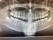 Pain Free Dentist Sydney - Dentist Dulwich Hill, Hurlstone Park NSW