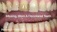 Pain Free Dentist Sydney - Dentist Dulwich Hill, Hurlstone Park NSW