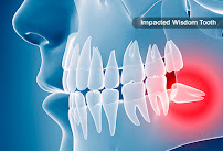 Pain Free Dentist Sydney - Dentist Dulwich Hill, Hurlstone Park NSW