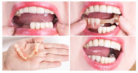 Ausmile Dental & Denture Studio