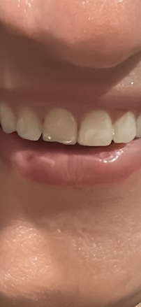 Smile Life Dental in Sydney