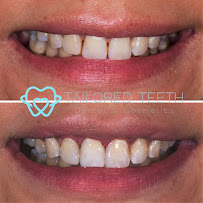 Tailored Teeth Dental Burwood