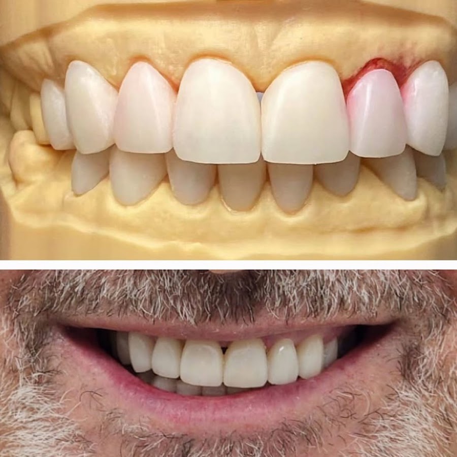 Burwood Diamond Dental