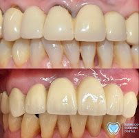 Burwood Diamond Dental