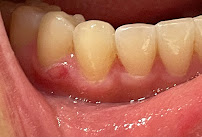 Bupa Dental Burwood