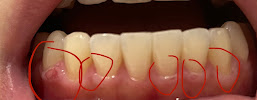 Bupa Dental Burwood
