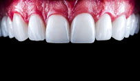Dr. Sam Gidaro | All-on-4 Dental Implants Sydney