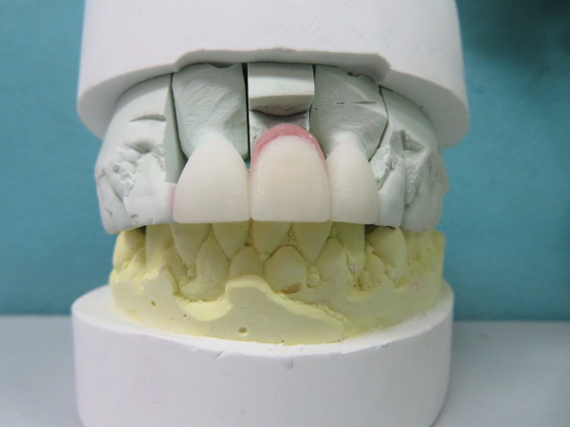 Blossom Dental Care