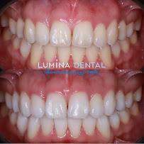 Lumina Dental Clinic Sydney