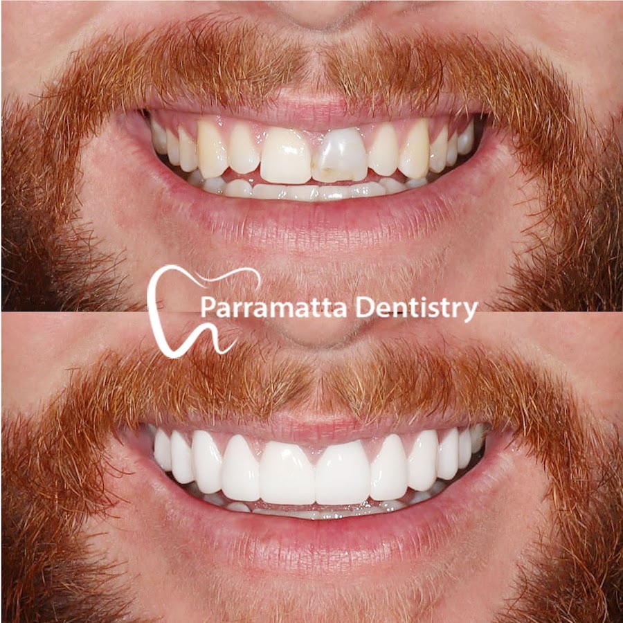 Parramatta Dentistry | Cosmetique Dental