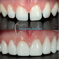 Parramatta Dentistry | Cosmetique Dental