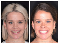 Spa Dental Parramatta