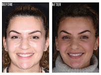 Spa Dental Parramatta