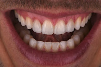 Spa Dental Parramatta