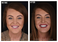 Spa Dental Parramatta