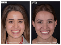 Spa Dental Parramatta