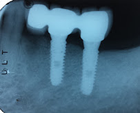 Parramatta Dental Studio