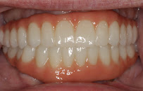 SYMPLANTS Dental Clinic in Sydney