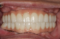 SYMPLANTS Dental Clinic