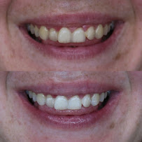 Smile Labs Sydney - Parramatta