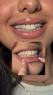 Sydney Teeth Whiteners