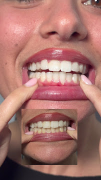 Sydney Teeth Whiteners