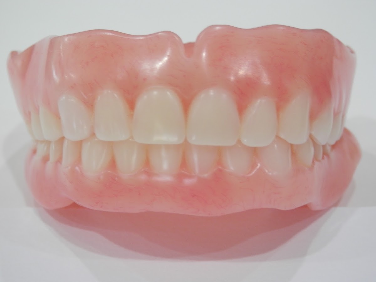 Sydney High Quality Dentures, Bob Song Denture Clinic Parramatta, New Partial Full Flexible Dentures