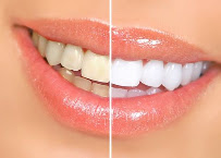 Always Smiles Dental Bankstown in Sydney