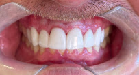 Perfection Dental - Bankstown