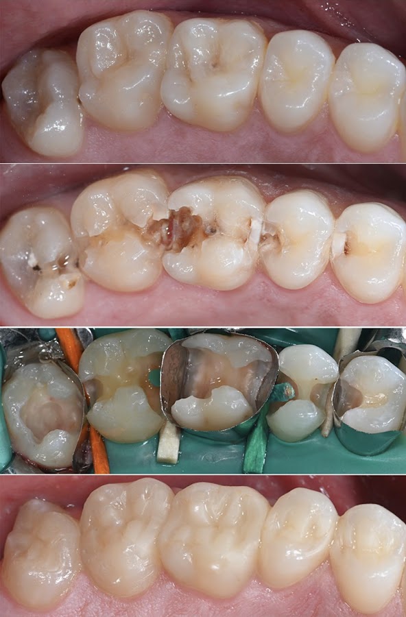 HealthPoint Dental liverpool