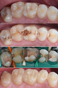 HealthPoint Dental liverpool in Sydney