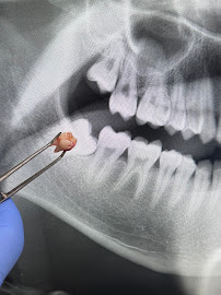 HealthPoint Dental liverpool