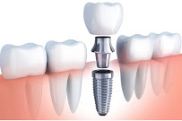 Liverpool Dental Centre - Family And Emergency Dentist Liverpool