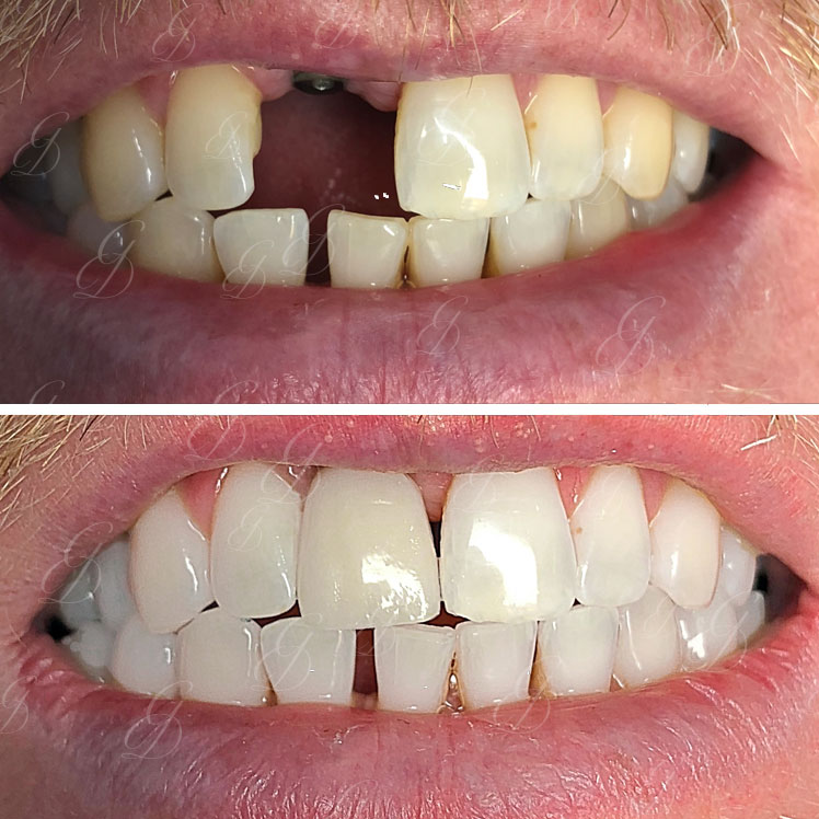 Gentle Dental Care Liverpool