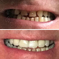 Gentle Dental Care Liverpool
