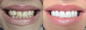 Gentle Dental Care Liverpool