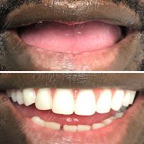 Gentle Dental Care Liverpool