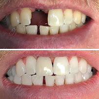 Gentle Dental Care Liverpool in Sydney
