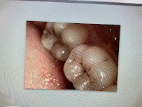 No Gaps Dental Westfield Liverpool