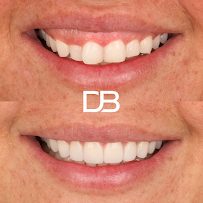 Dental Boutique Liverpool