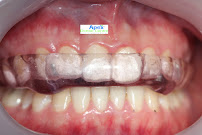 Apex Dental Centre Liverpool